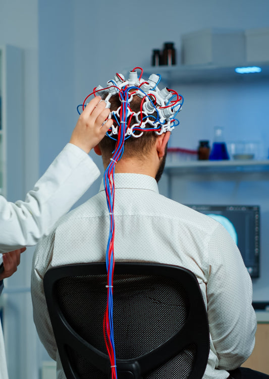 TRATAMIENTO PARA LA EPILEPSIA