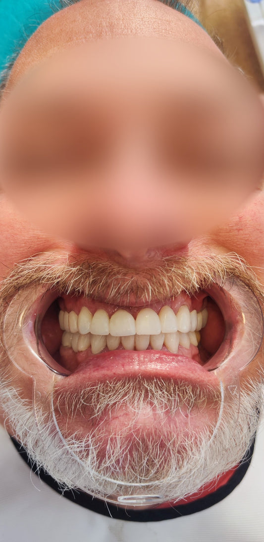 DISEÑO DE SONRISA