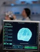 TRATAMIENTO PARA LA EPILEPSIA